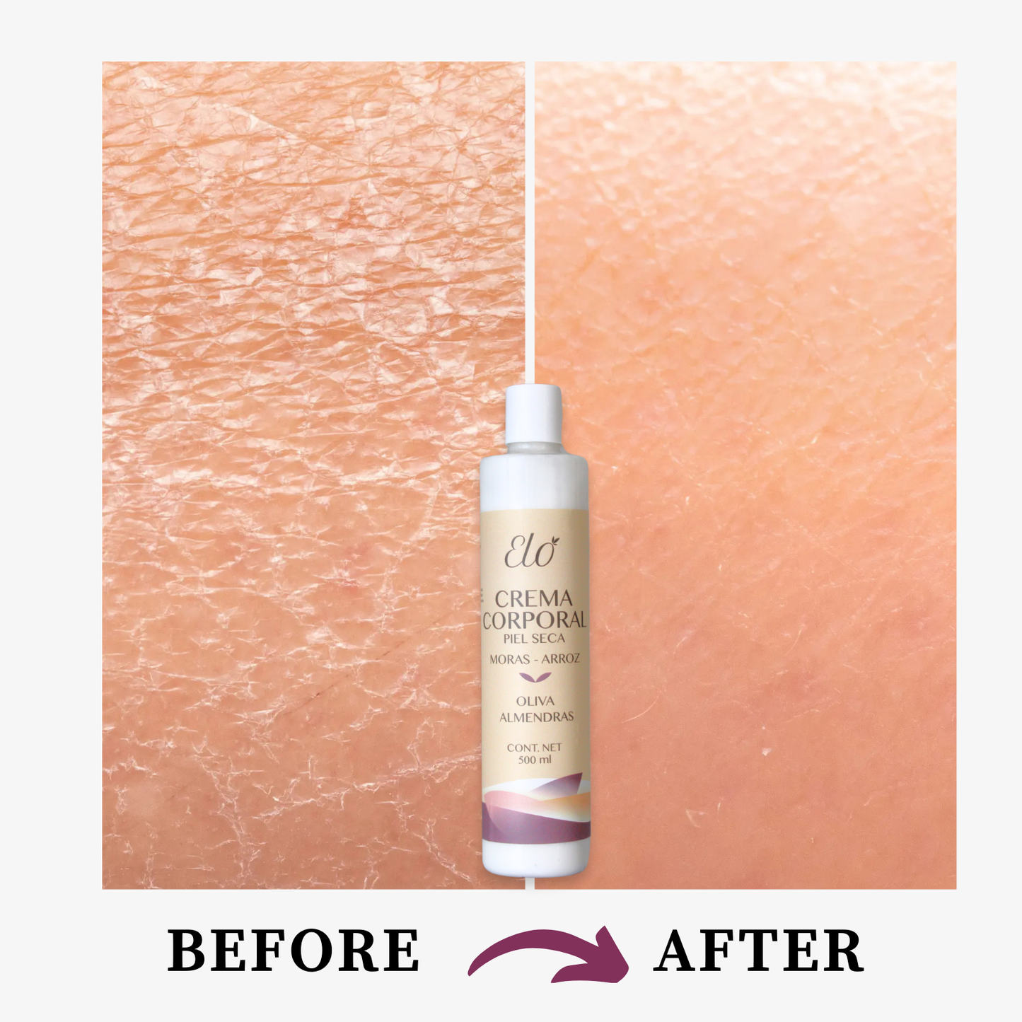 Crema Corporal Piel Seca